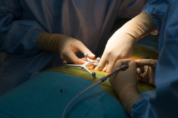 Spine Surgery
